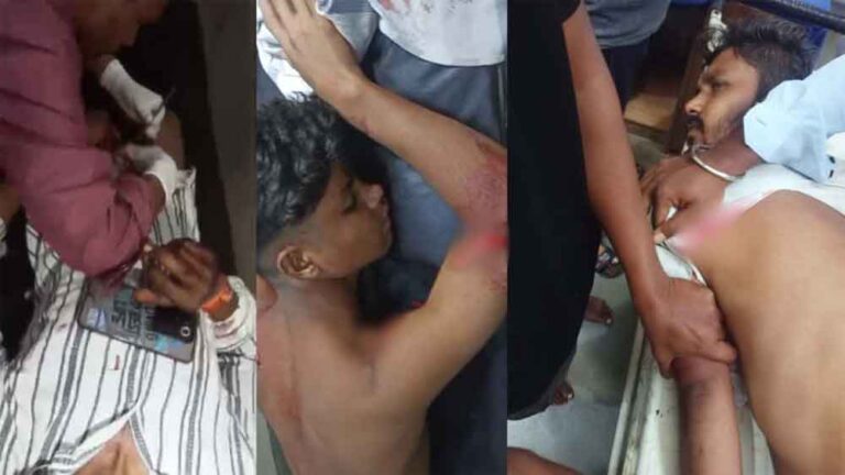 छत्तीसगढ़-दुर्ग में चाकूबाजी और कटरबाजी की घटनाओं में 3 लोग पहुंचे अस्पताल छत्तीसगढ़-दुर्ग में चाकूबाजी और कटरबाजी की घटनाओं में 3 लोग पहुंचे अस्पताल