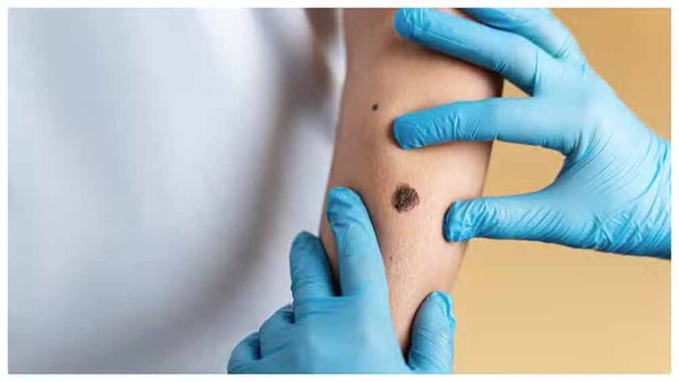 जिस संक्रामक रोग के कारण दो बार घोषित हुआ ‘आपातकाल’, कई देशों में फिर बढ़ने लगे उसके मामले