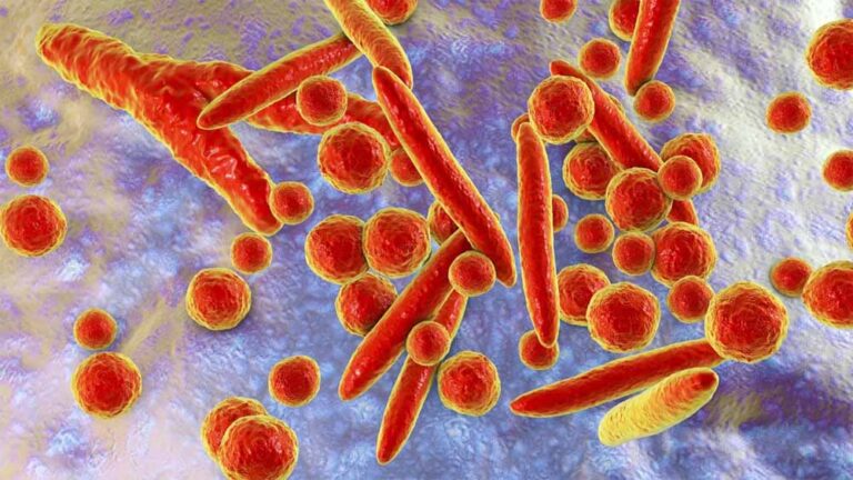 जापान में माइकोप्लाज्मा निमोनिया के मामलों में वृद्धि देखी जा रही