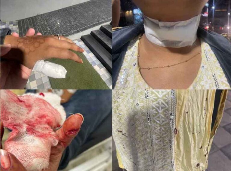 छत्तीसगढ़-रायपुर में पिता के साथ पार्क घूमने जा रहे बच्चे का चाइनीज मांझे से गला कटने से मौत छत्तीसगढ़-रायपुर में पिता के साथ पार्क घूमने जा रहे बच्चे का चाइनीज मांझे से गला कटने से मौत