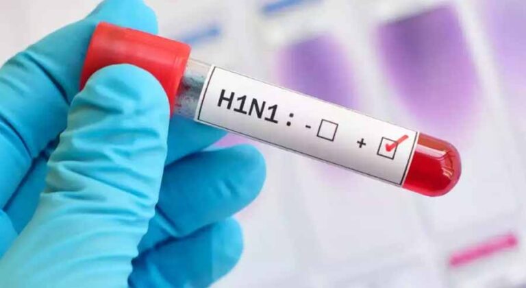 बदलते मौसम में फ्लू और वायरल इन्फेक्शन के मामलो में तेजी, दिल्ली में स्वाइन फ्लू के 3 हजार ज्यादा मामले बदलते मौसम में फ्लू और वायरल इन्फेक्शन के मामलो में तेजी, दिल्ली में स्वाइन फ्लू के 3 हजार ज्यादा मामले