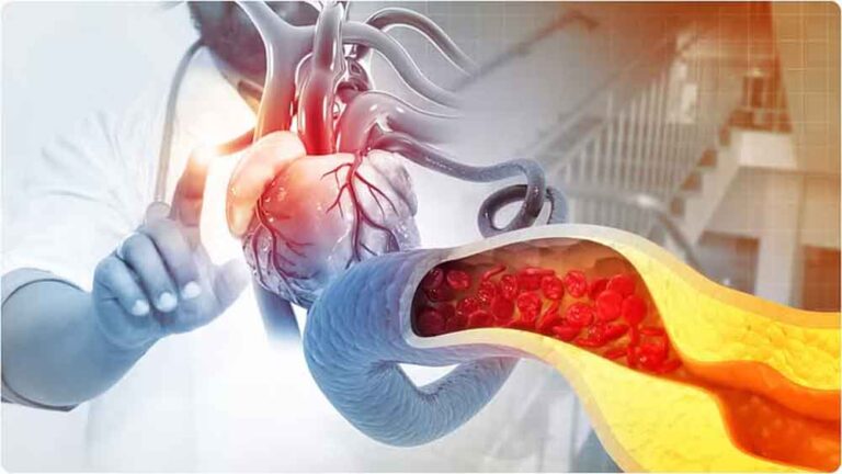 कोलेस्ट्रॉल बढ़ने से सिर्फ हृदय रोग ही नहीं इन गंभीर समस्याओं का भी बढ़ जाता है खतरा, बरतें सावधानी कोलेस्ट्रॉल बढ़ने से सिर्फ हृदय रोग ही नहीं इन गंभीर समस्याओं का भी बढ़ जाता है खतरा, बरतें सावधानी