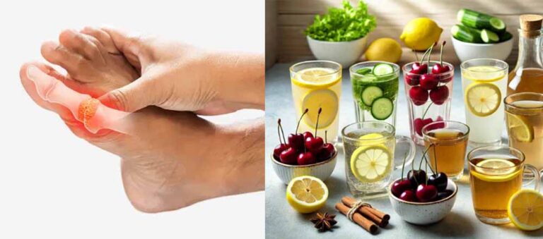 यूरिक एसिड कम करने के लिए पिएं ये ड्रिंक्स