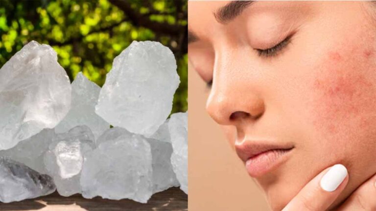 फिटकरी का इस्तेमाल कर गर्मियों में स्किन की करे देख भाल