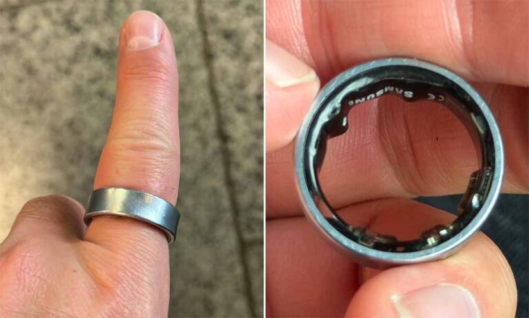 हवाई सफर में अड़चन: उंगली में फंसी स्‍मार्ट रिंग से बिगड़ी यात्री की हालत