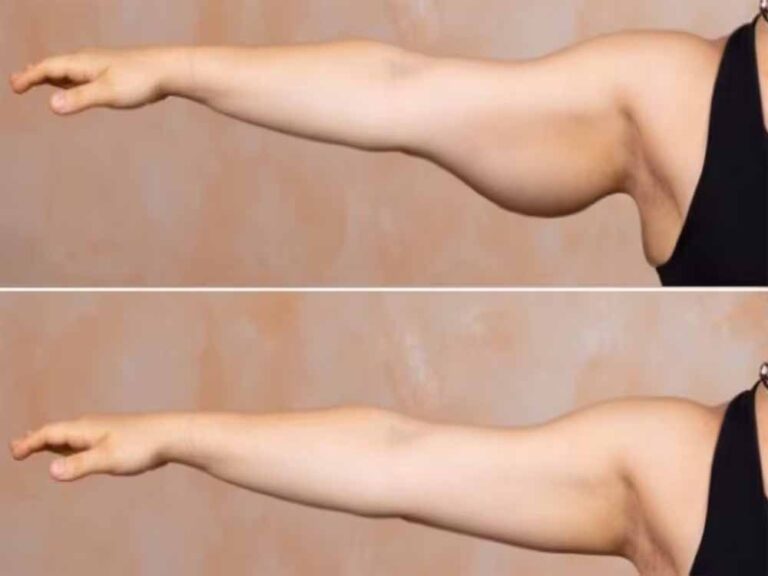 बाजू की ढीली मांसपेशियों को टोन्ड बनाने के लिए रोज करें ये 5 एक्सरसाइज, बढ़ जाएगी हाथों की ताकत