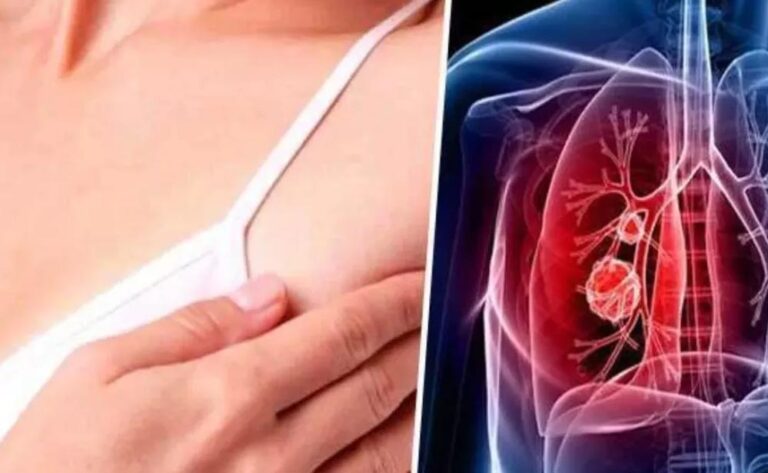 भारत में कैंसर की बढ़ती चुनौती: पुरुषों में फेफड़े और महिलाओं में ब्रेस्ट कैंसर सबसे आम