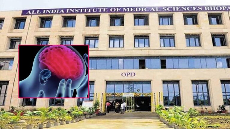 एम्स भोपाल में शुरू हुई एडवांस्ड स्ट्रोक ट्रीटमेंट यूनिट, 24 घंटे उपलब्ध रहेगा इलाज