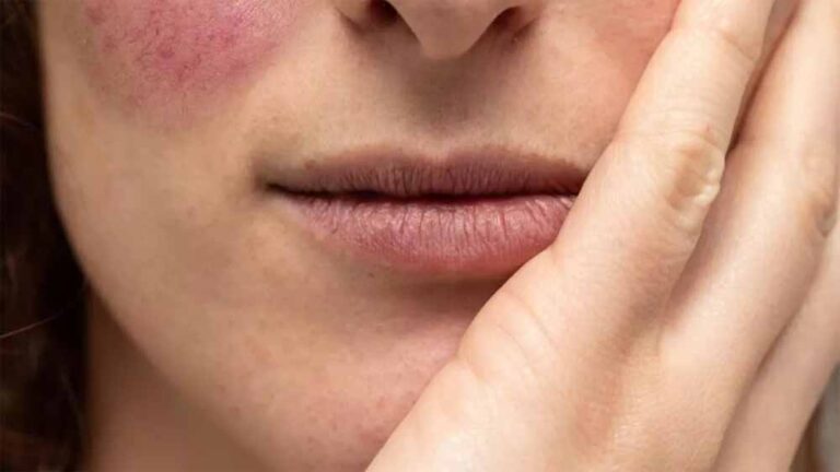 रूखी-बेजान स्किन का रामबाण इलाज: ये घरेलू उपाय देंगे मुलायम और ग्लोइंग चेहरा