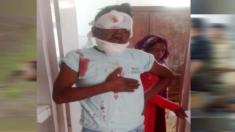 ब्रेकर में बाइक जैंपिंग होने से हादसा: चालक को आया गंभीर रूप से जख्म