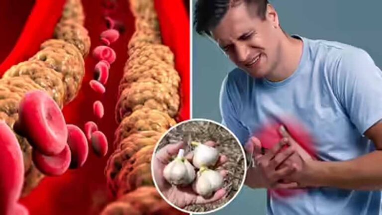 खाली पेट लहसुन खाने का दावा कितना सही? कोलेस्ट्रॉल पर असर जानिए खाली पेट लहसुन खाने का दावा कितना सही? कोलेस्ट्रॉल पर असर जानिए