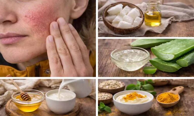 विंटर स्किन केयर टिप्स: दही से बने 5 फेस पैक, जो बनाएंगे स्किन सॉफ्ट और हाइड्रेटेड