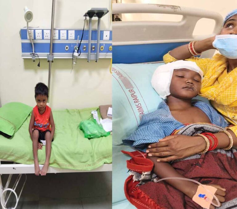 चिरायु योजना से बदली जिंदगी, एम्स रायपुर में तीन बच्चों का सफल कॉक्लियर इंप्लांट