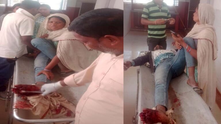 ऑटो और बाइक की टक्कर में बाइक चालक को गंभीर चोटें, पैर की दो उंगलियां टूटने की आशंका