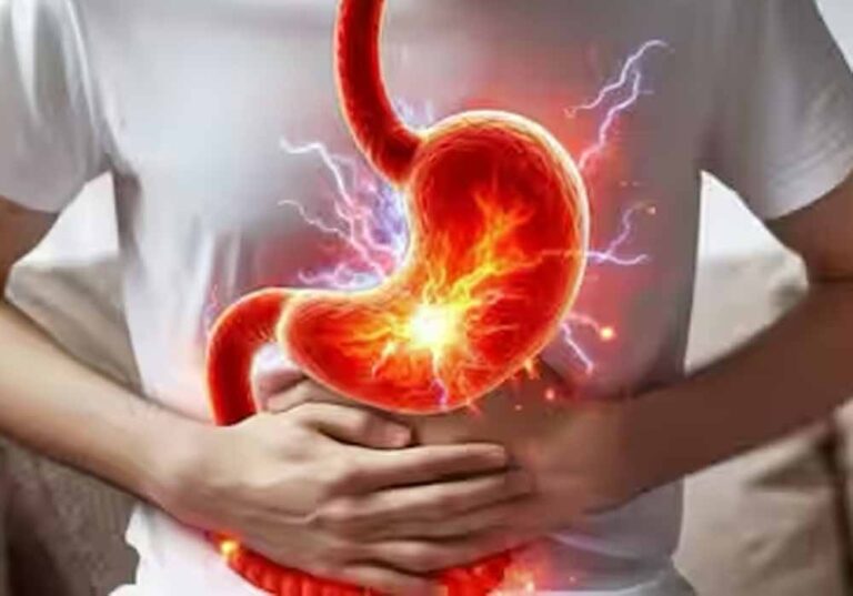 अल्सर से कैसा डर! सही जानकारी से बीमारी पर जीत